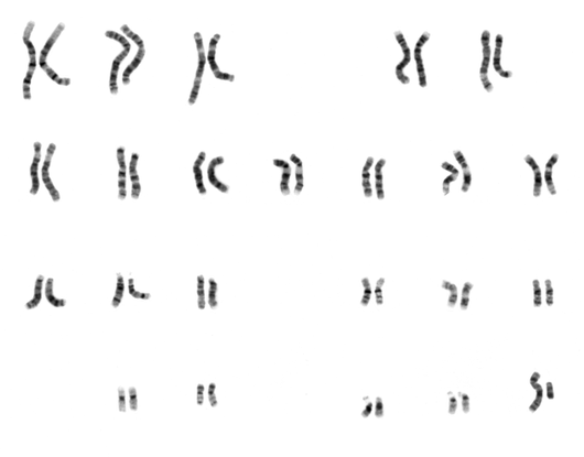 Homologous Chromosomes